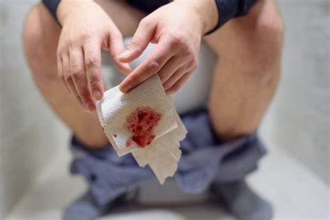 What Can Blood On Toilet Paper But Not On Stool Mean Scary Symptoms