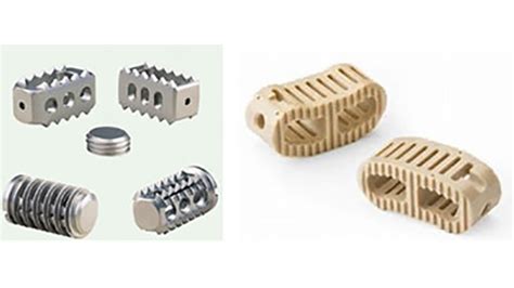 Depuy Synthes Acquires 3d Printing Tech To Treat Bone Defects Todays