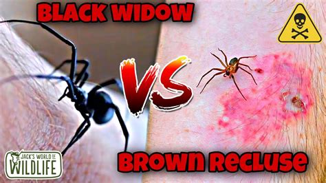 Black Widow Bite