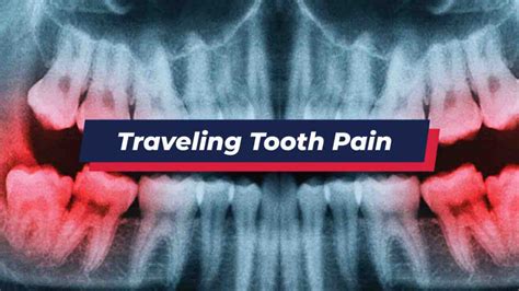 Shooting Pains In Teeth Standstory