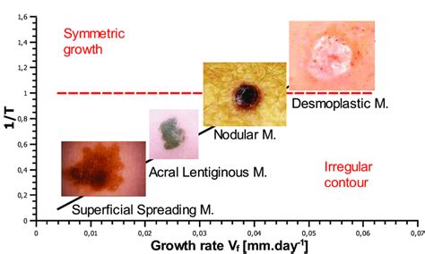 Estimation Of The Control Parameter T For Slow Growing Melanomas