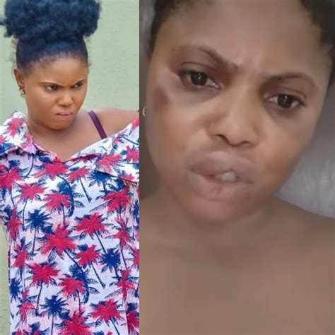 They Want To Kill Me Because Of A Movie I Shot Actress Evan Okoro Cries Out With Battered Face