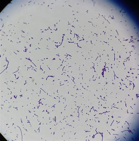 Listeria monocytogenes is the species of pathogenic bacteria that causes the infection listeriosis. 16 best Gram stains of bacteria images on Pinterest ...