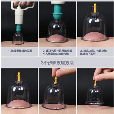 12 Cupsset Chinese Medical Healthy Body Vacuum Cupping Suction Therapy Massage Ebay
