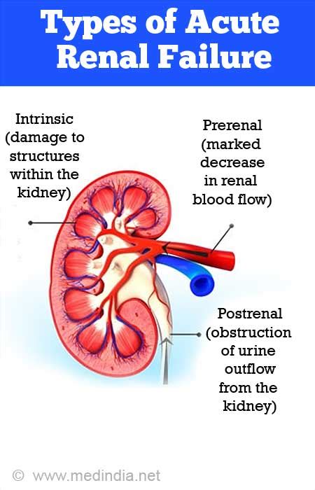 Is Kidney Failure Considered A Terminal Illness