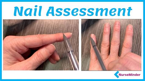Nail Assessment For Nursing Normal And Abnormal Findings Youtube
