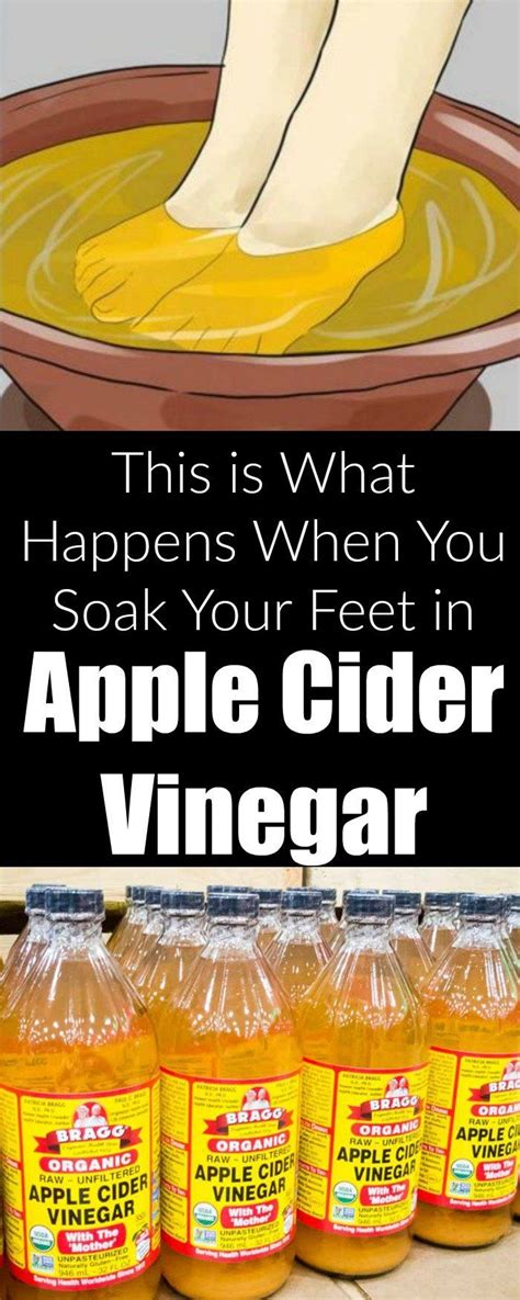 Apple Cider Vinegar Foot Soak Apple Cider Vinegar Uses Apple Cider