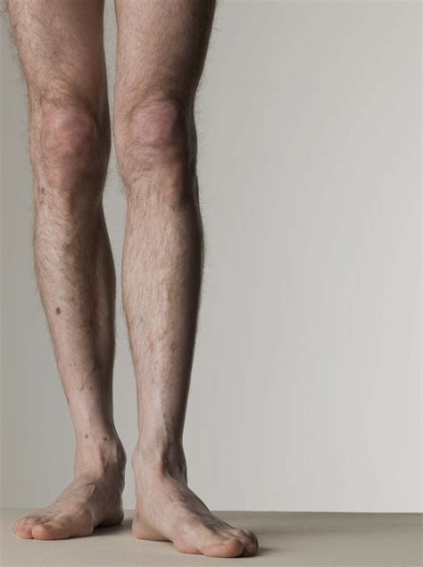 How Men Can Lose Leg Fat Quickly Chron Com