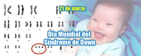 Día mundial del síndrome de down. Tarjetas para el dia internacional del Sindrome de Down ...