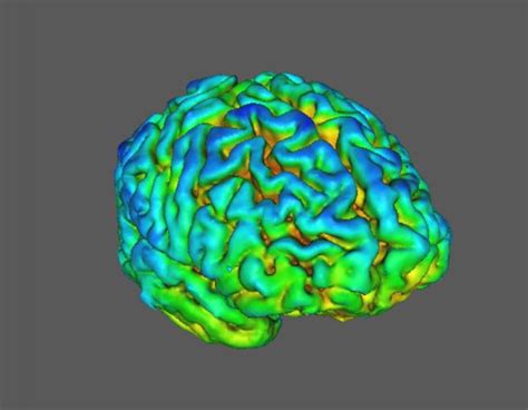 Schizophrenia Sv2a Brain Scan Image Eurekalert Science News Releases