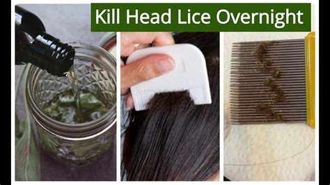 Homemade Hair Oil For Lice And Nits Removal Kill Head Lice And Nits