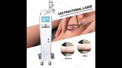FemiLift Laser System Surgery Fractional CO2 Laser Wrinkle Removal