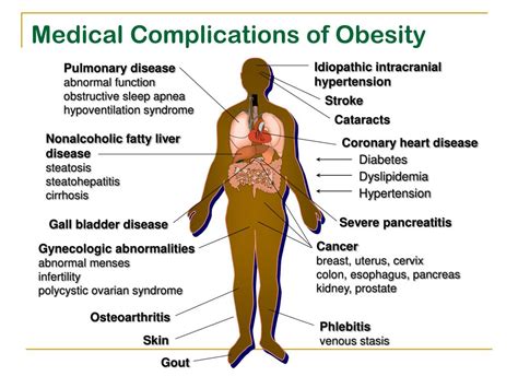 ppt lecture 8 complications of obesity powerpoint presentation free download id 5560435