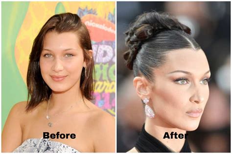 bella hadid before and after the model s biography and lyme disease struggle yen gh