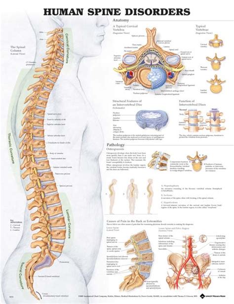 This framework consists of many individual bones and cartilages. The Human Spine Disorders Chart - MedWest Medical Supplies