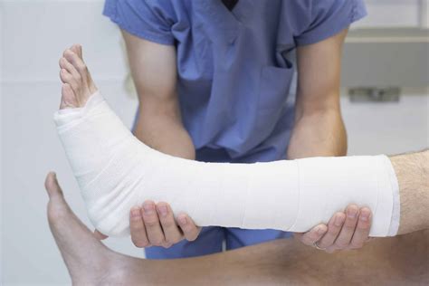 Determine If You Need A Personal Injury Lawyer For A Broken Bone
