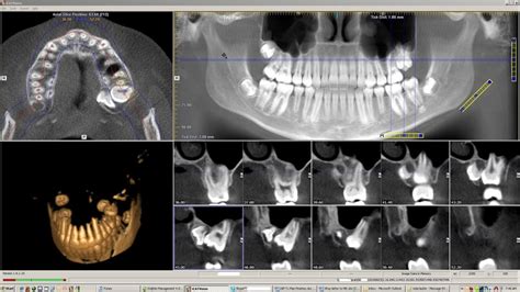 Icat Imaging Island Orthodontics Dr Vohn S Rosang