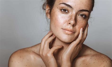 What Kind Of Skin Issues Does Melasma Cream Treat Motivirus