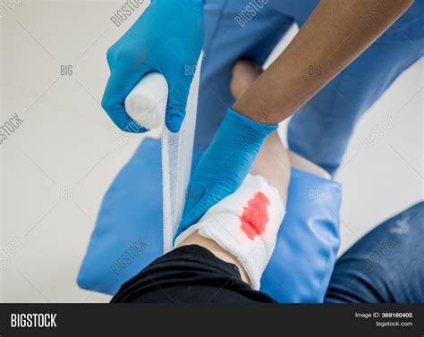 Nurse Dressing Wound Image And Photo Free Trial Bigstock