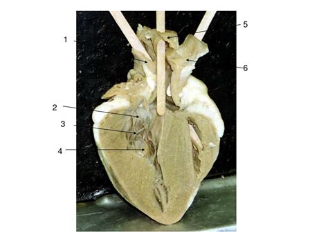 Ppt Fibrous Pericardium Pericardial Sac Powerpoint Presentation