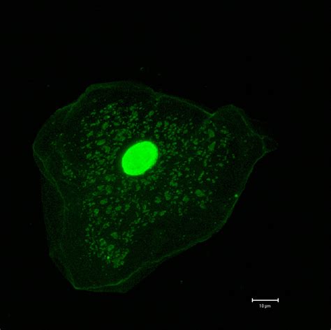 The cell membrane of the cheek cell is semi permeable and it surrounds the cytoplasm. Delaware science teachers sharpen their skills at DBI