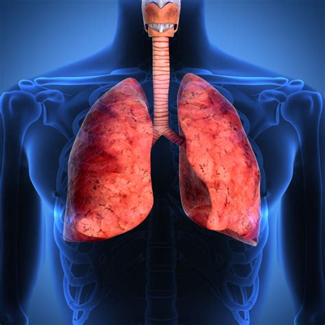 Researchers Find That Lung Cancer Patients With Brain Metastases And