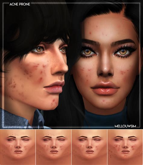 Acne Prone Mask The Sims 4 Skin Sims Sims 4