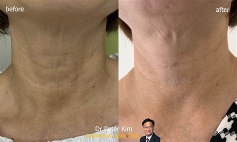 Dr Peter Kim Surgery Skin Cancer Cosmetic And Laser Clinic