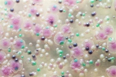Mixed Culture Of Candida Yeasts Photograph By Daniela Beckmann