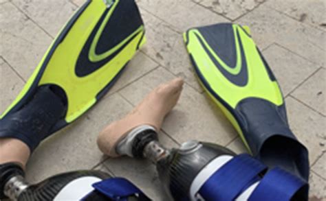 Double Leg Amputee Shaun Whiter Receives Prosthetic Swim Legs