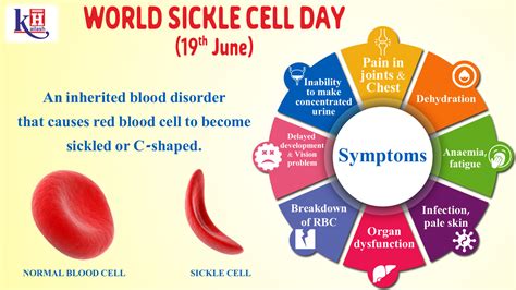 World Sickle Cell Day 19th June