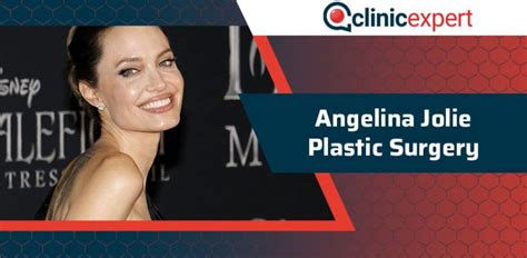 Angelina Jolie Plastic Surgery Clinicexpert International Healthcare