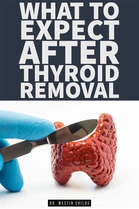 This Thyroidectomy Recovery Guide Will Walk You Through Everything You