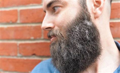 7 common beard problems and how to treat them