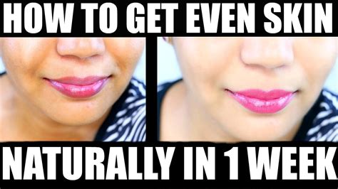 How To Get Clear Skin And Even Skin Tone Naturally In 1 Week