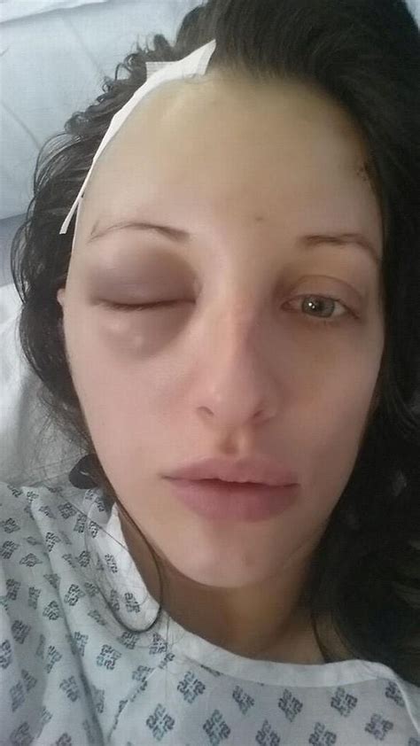 Symptoms of metastatic cancer may depend on where in the body the cancer has spread. Former Miss UK and Playboy bunny battling cancer told ...