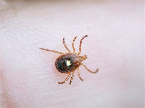 Fears Of Tick Spreading Among Humans Whose Bite Makes You Allergic To