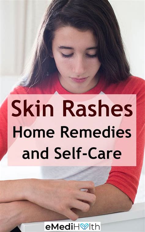 Itching Skin Remedies Natural Rash Remedies Skin Rash Remedies Heat