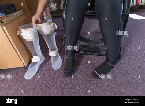 Woman With Spinal Cord Injury Working With Her Leg Braces Stock Photo