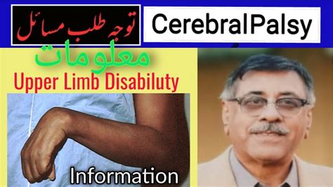 Spastic Cerebral Palsy Upper Limb Issues Complete Management
