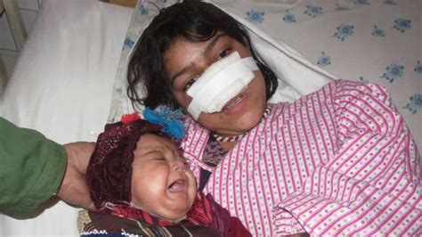 Reza Gul The Afghan Woman Whose Husband Cut Off Her Nose Bbc News