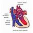Atresia Pulmonar  American Heart Association