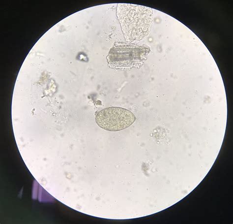 Egg Parasite Human In Stool Examination Stock Image Image Of Nematode