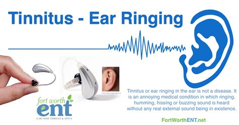 Tinnitus Ear Ringing Fort Worth Ent And Sinus
