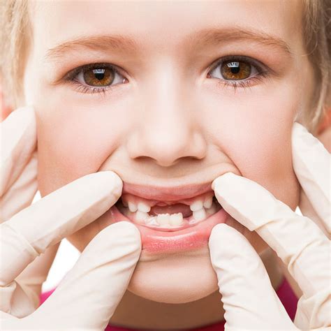 Guatemala Odontología Pediátrica Adolescentes Dentistas Especialistas