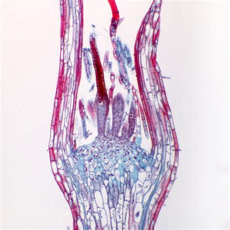 Moss Mnium Archegonia Head Ls Microscope Slide Southern Biological