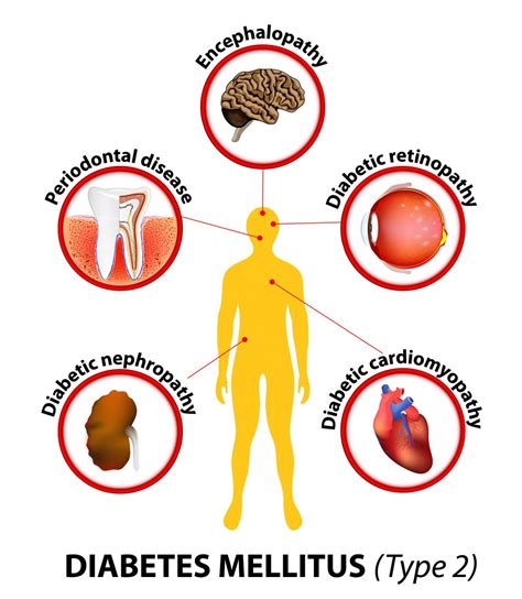 Cardiorrenal.es | Cuidado de órganos diana