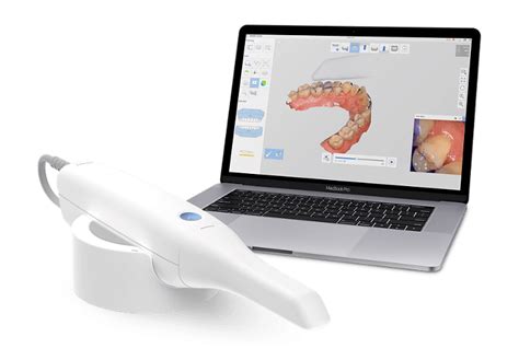 Intraoral Scanner Comparison 2022 Pros And Cons Of The Top Scanners 2023