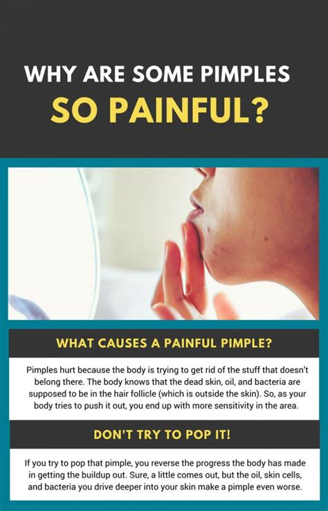 Painful Pimple Causes Epiphany Dermatology
