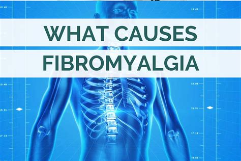 What You Need To Know About The Causes Of Fibromyalgia
